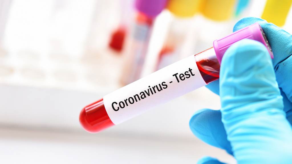 U Hrvatskoj 46 zaraženih koronavirusom, uvedene mjere kontrole cijena za određene proizvode